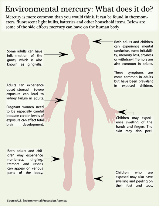 acrodynia due to mercury poisoning